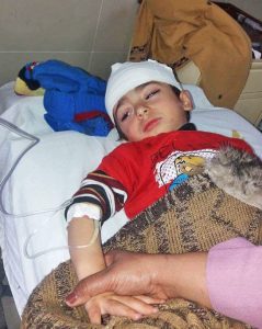 Injured child in Quetta