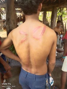 Victim with back wounds