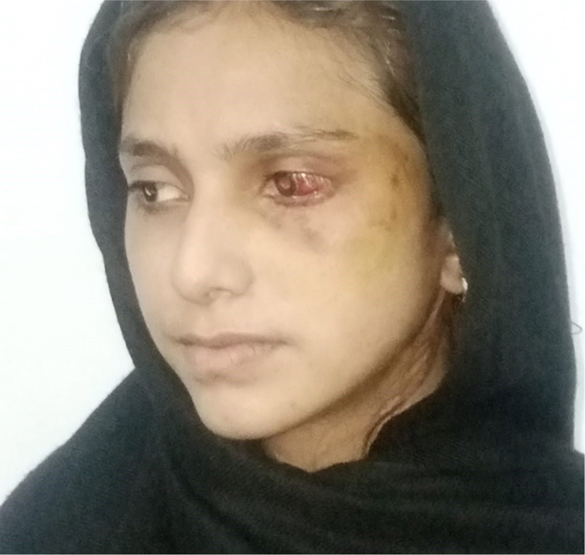 PAKISTAN: Christian woman escapes from captivity